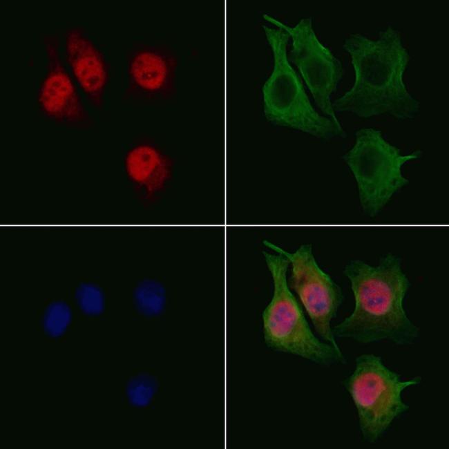 RECQ4 Antibody in Immunocytochemistry (ICC/IF)