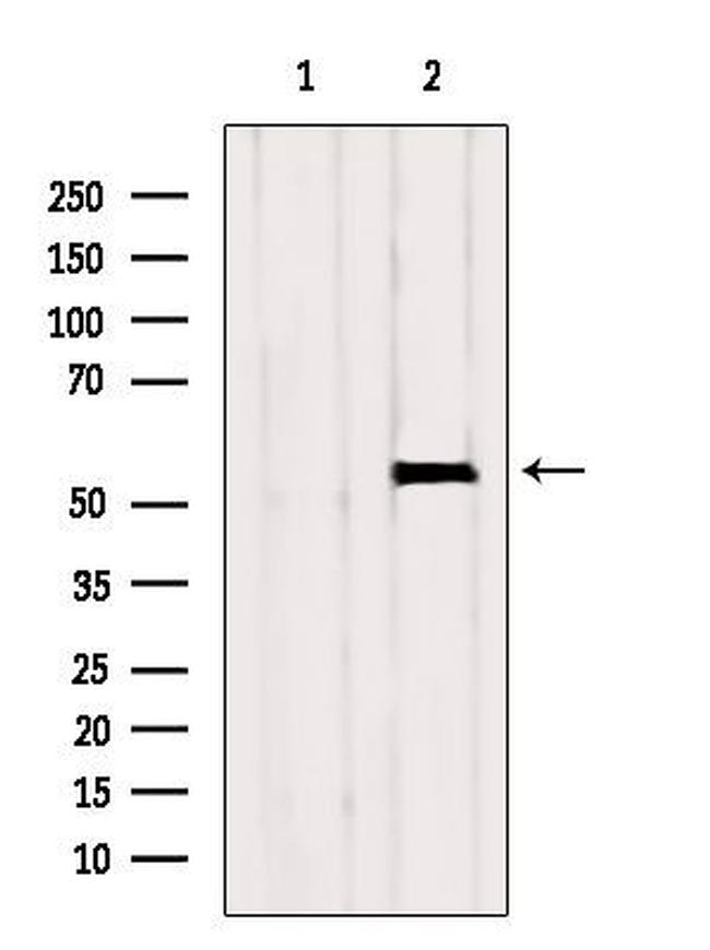 GCNT4 Antibody in Western Blot (WB)