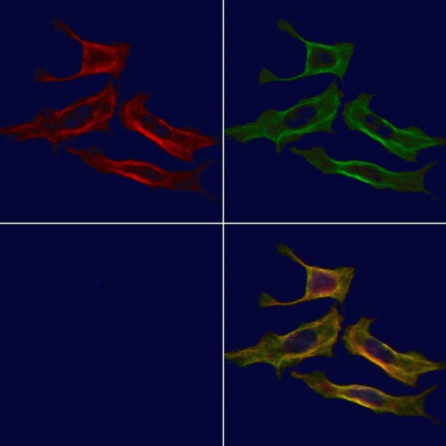 B3GALT6 Antibody in Immunocytochemistry (ICC/IF)