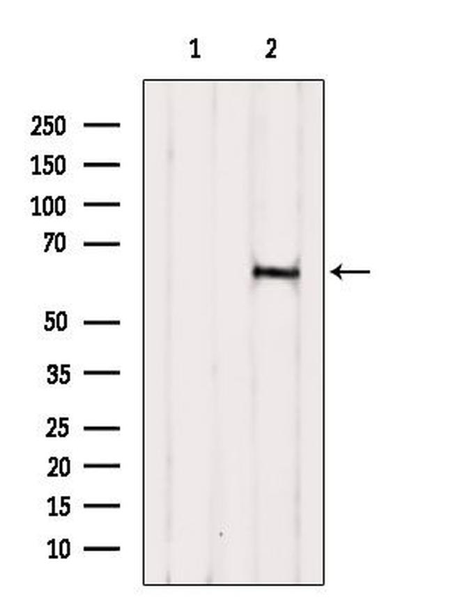 B4GALNT2 Antibody in Western Blot (WB)