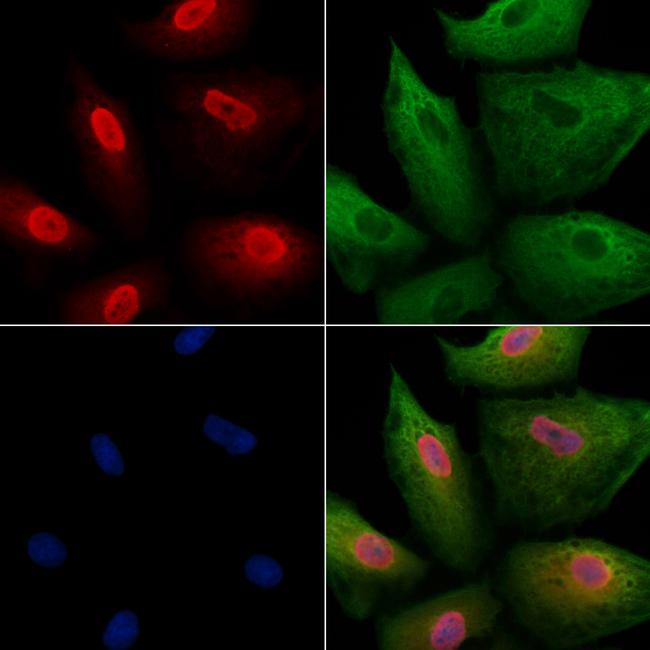 PCP4 Antibody in Immunocytochemistry (ICC/IF)