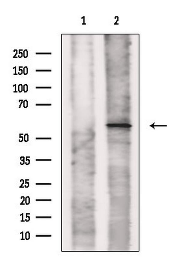 SLC22A17 Antibody in Western Blot (WB)