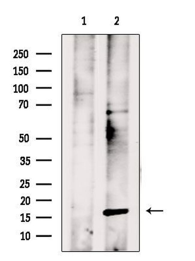 PPP3R1 Antibody in Western Blot (WB)