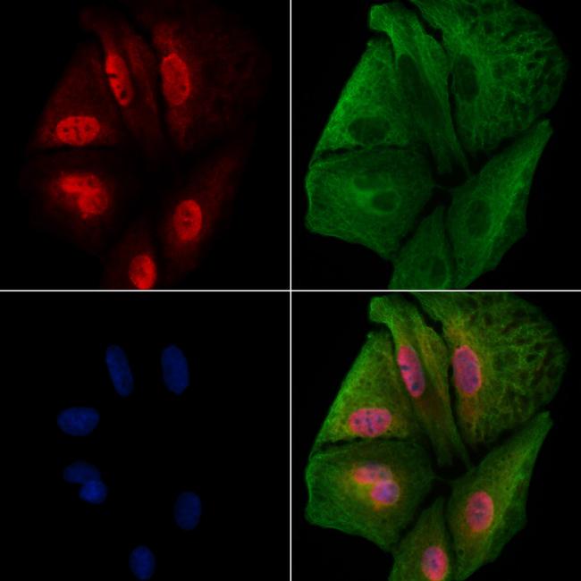 CABIN1 Antibody in Immunocytochemistry (ICC/IF)