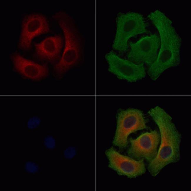 SLC25A13 Antibody in Immunocytochemistry (ICC/IF)