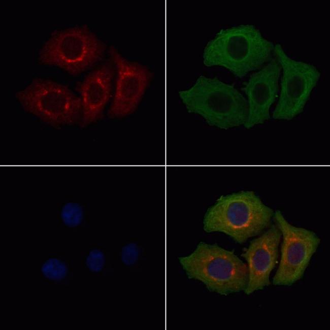 Calponin 3 Antibody in Immunocytochemistry (ICC/IF)