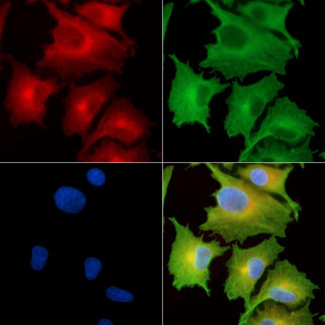 CHST5 Antibody in Immunocytochemistry (ICC/IF)