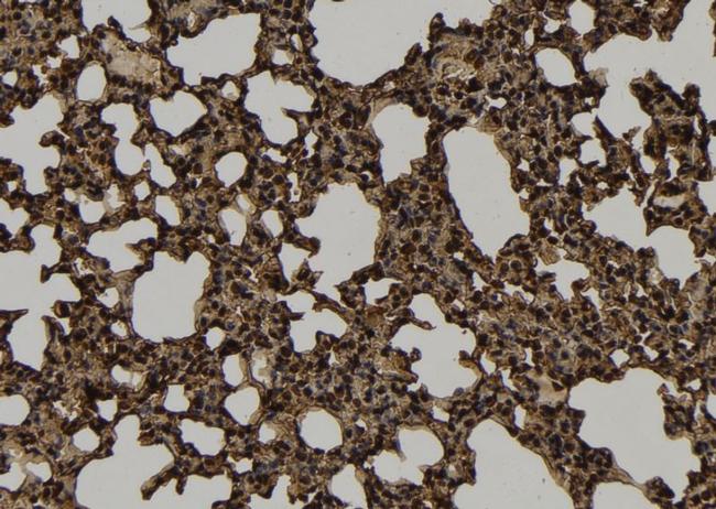 KIF4B Antibody in Immunohistochemistry (Paraffin) (IHC (P))