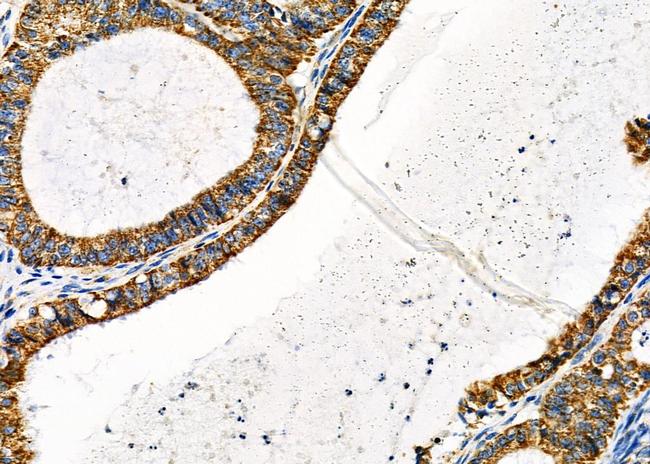 MCU Antibody in Immunohistochemistry (Paraffin) (IHC (P))