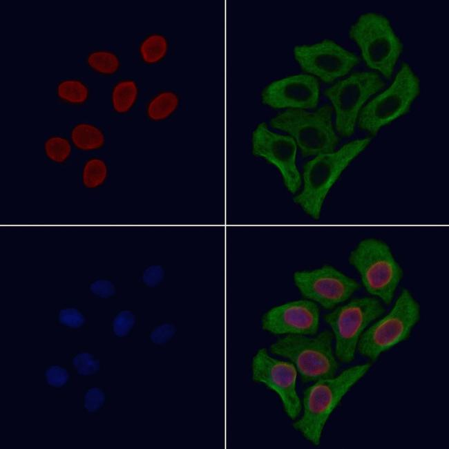 NCAPD3 Antibody in Immunocytochemistry (ICC/IF)