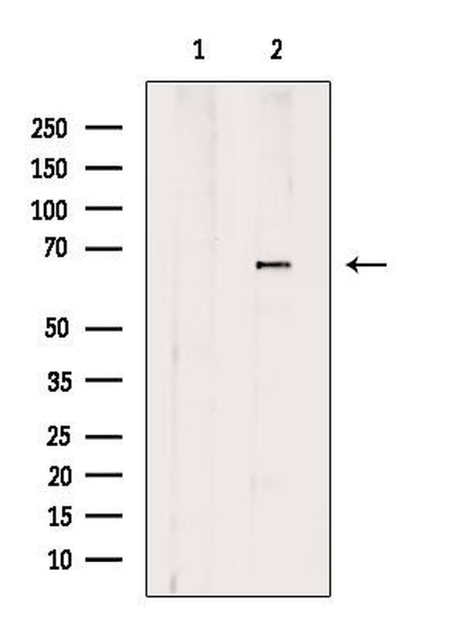 NT5C2 Antibody in Western Blot (WB)