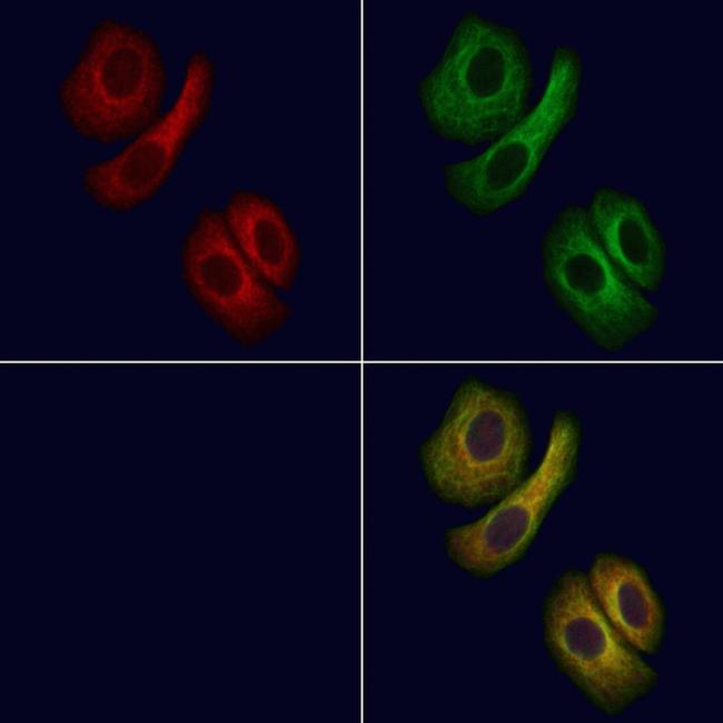 DGAT2 Antibody in Immunocytochemistry (ICC/IF)