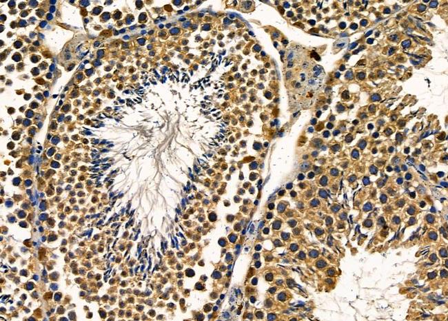 POLR2H Antibody in Immunohistochemistry (Paraffin) (IHC (P))