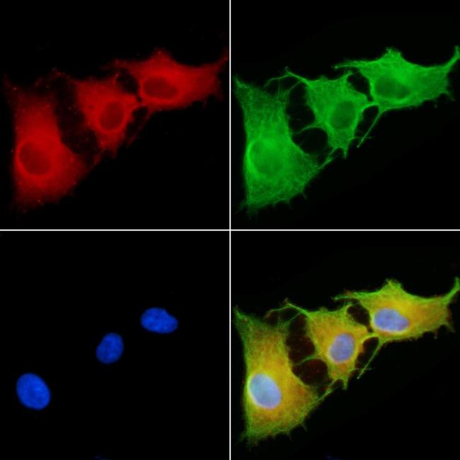 RNF5 Antibody in Immunocytochemistry (ICC/IF)