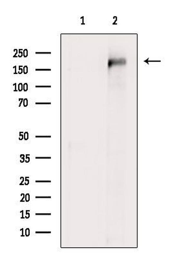 UBR2 Antibody in Western Blot (WB)