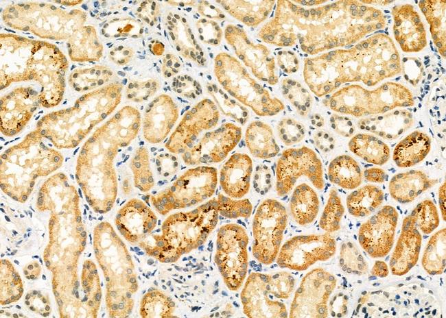 ELP3 Antibody in Immunohistochemistry (Paraffin) (IHC (P))