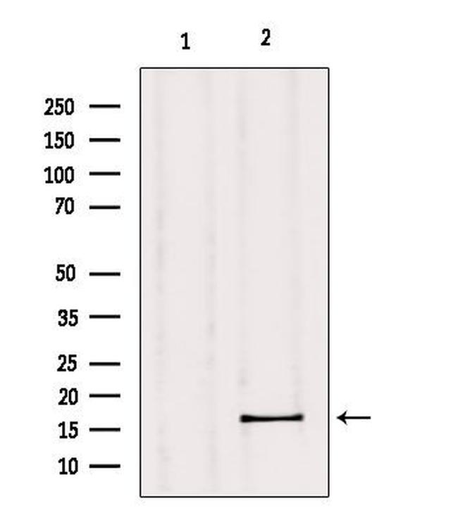 GPSM3 Antibody in Western Blot (WB)