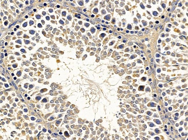 GCH1 Antibody in Immunohistochemistry (Paraffin) (IHC (P))