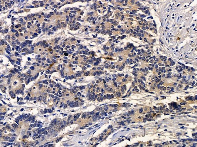 TRIM23 Antibody in Immunohistochemistry (Paraffin) (IHC (P))