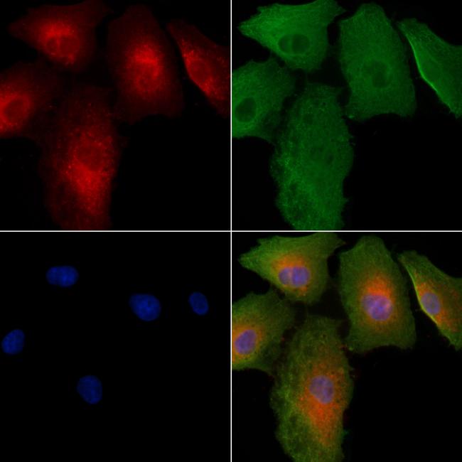 SAR1A Antibody in Immunocytochemistry (ICC/IF)