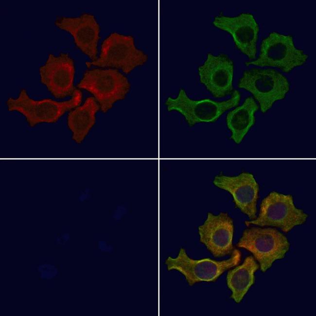 GNB3 Antibody in Immunocytochemistry (ICC/IF)