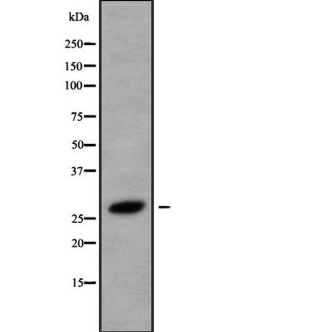 HOXB8 Antibody in Western Blot (WB)