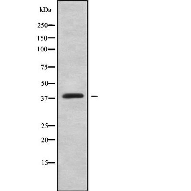 HOXC10 Antibody in Western Blot (WB)