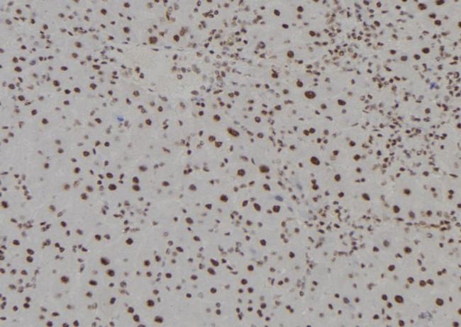 HOXC13 Antibody in Immunohistochemistry (Paraffin) (IHC (P))