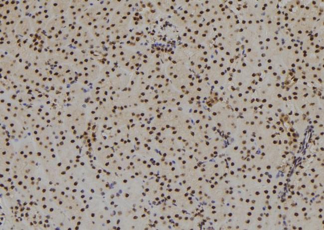 SIX3 Antibody in Immunohistochemistry (Paraffin) (IHC (P))