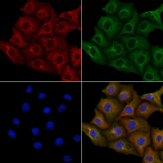 KIR2DS5 Antibody in Immunocytochemistry (ICC/IF)