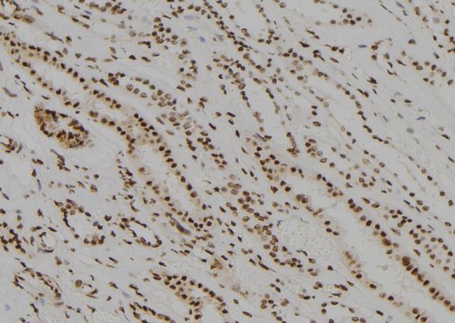 MED22 Antibody in Immunohistochemistry (Paraffin) (IHC (P))