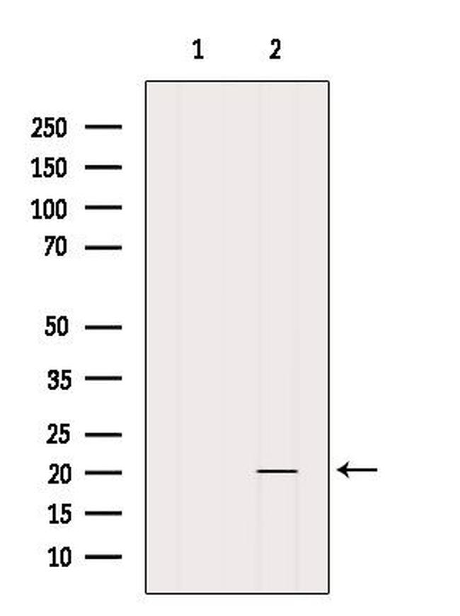 MED30 Antibody in Western Blot (WB)