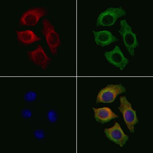 SLC16A11 Antibody in Immunocytochemistry (ICC/IF)