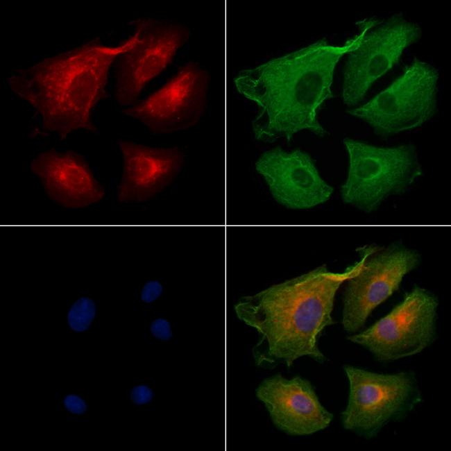 SLC16A6 Antibody in Immunocytochemistry (ICC/IF)