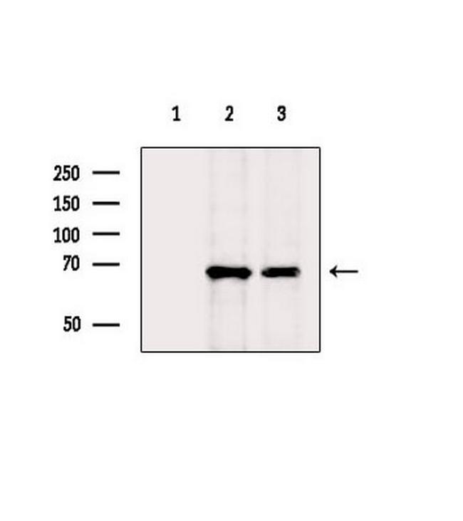 SLC16A9 Antibody in Western Blot (WB)