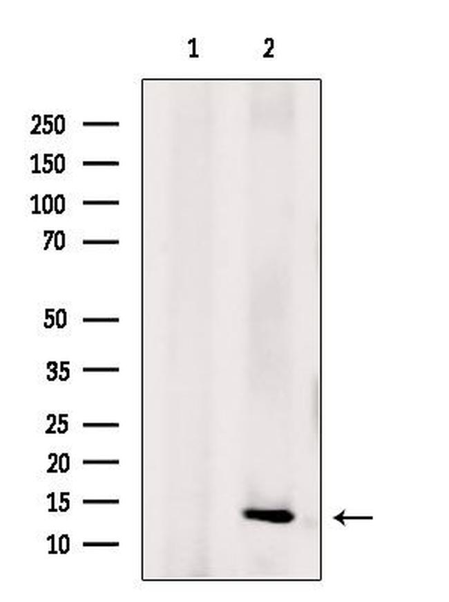 NDUFA5 Antibody in Western Blot (WB)