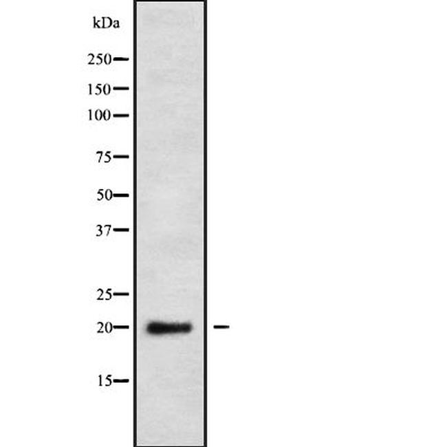 NDUFS4 Antibody in Western Blot (WB)