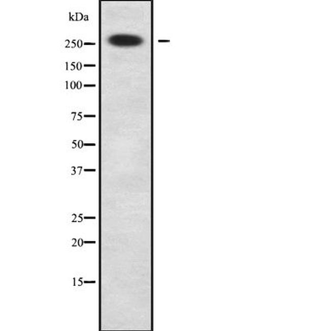 NBAS Antibody in Western Blot (WB)