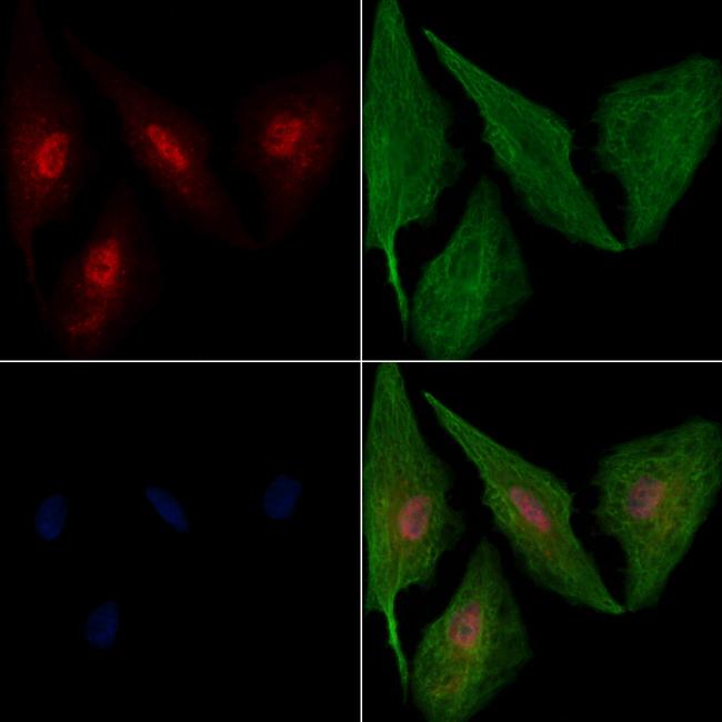 NAV2 Antibody in Immunocytochemistry (ICC/IF)