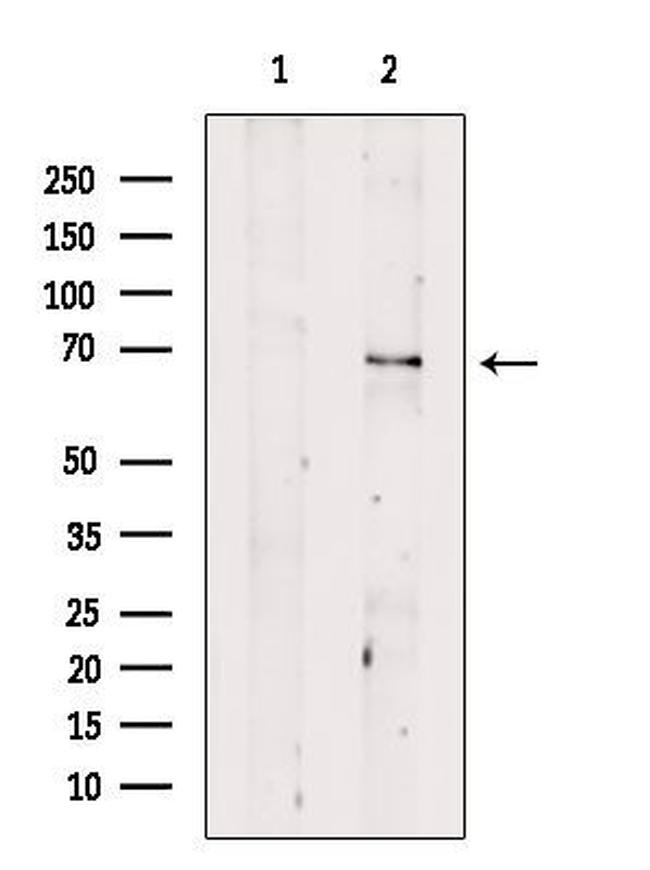 CHRNB4 Antibody in Western Blot (WB)