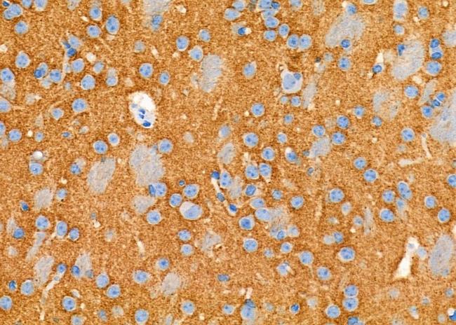 GPM6B Antibody in Immunohistochemistry (Paraffin) (IHC (P))