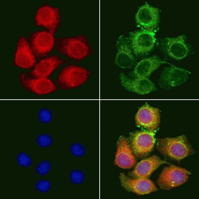 DFNA5 Antibody in Immunocytochemistry (ICC/IF)