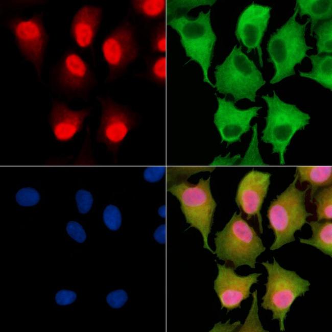 TNP2 Antibody in Immunocytochemistry (ICC/IF)