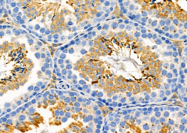 SLC6A17 Antibody in Immunohistochemistry (Paraffin) (IHC (P))