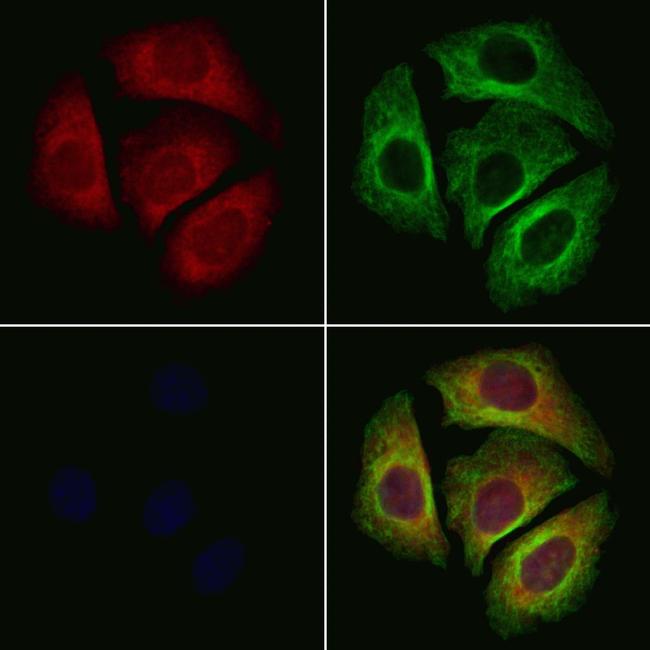 P2X1 Antibody in Immunocytochemistry (ICC/IF)