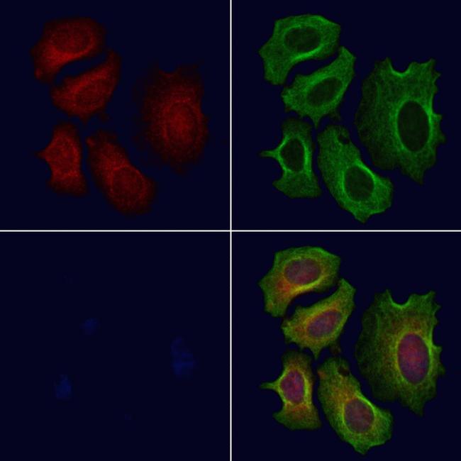 CROT Antibody in Immunocytochemistry (ICC/IF)