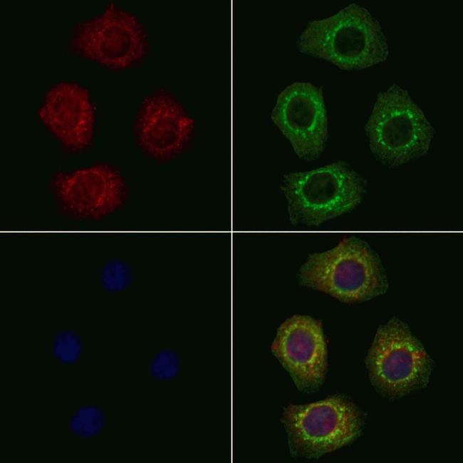 PEX6 Antibody in Immunocytochemistry (ICC/IF)