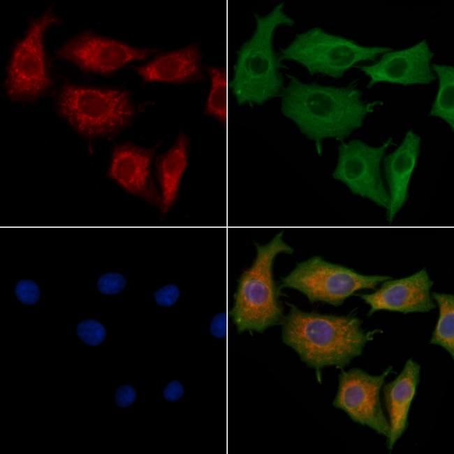 PEX12 Antibody in Immunocytochemistry (ICC/IF)