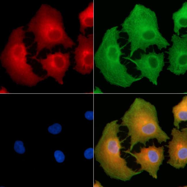 INPP5J Antibody in Immunocytochemistry (ICC/IF)