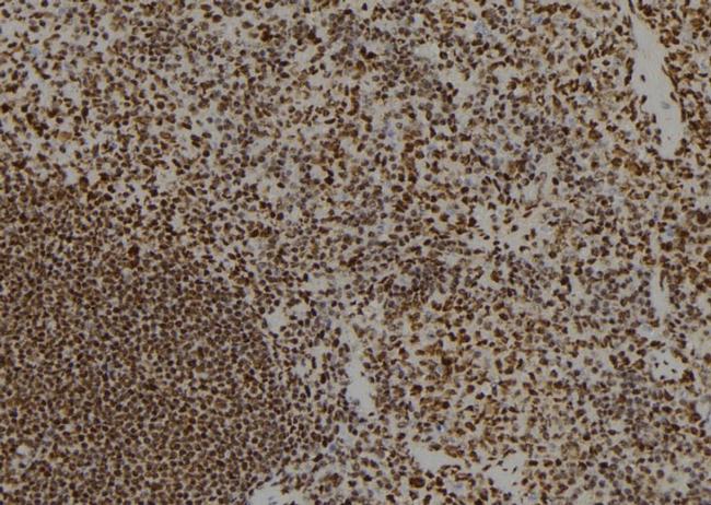 PPM1E Antibody in Immunohistochemistry (Paraffin) (IHC (P))